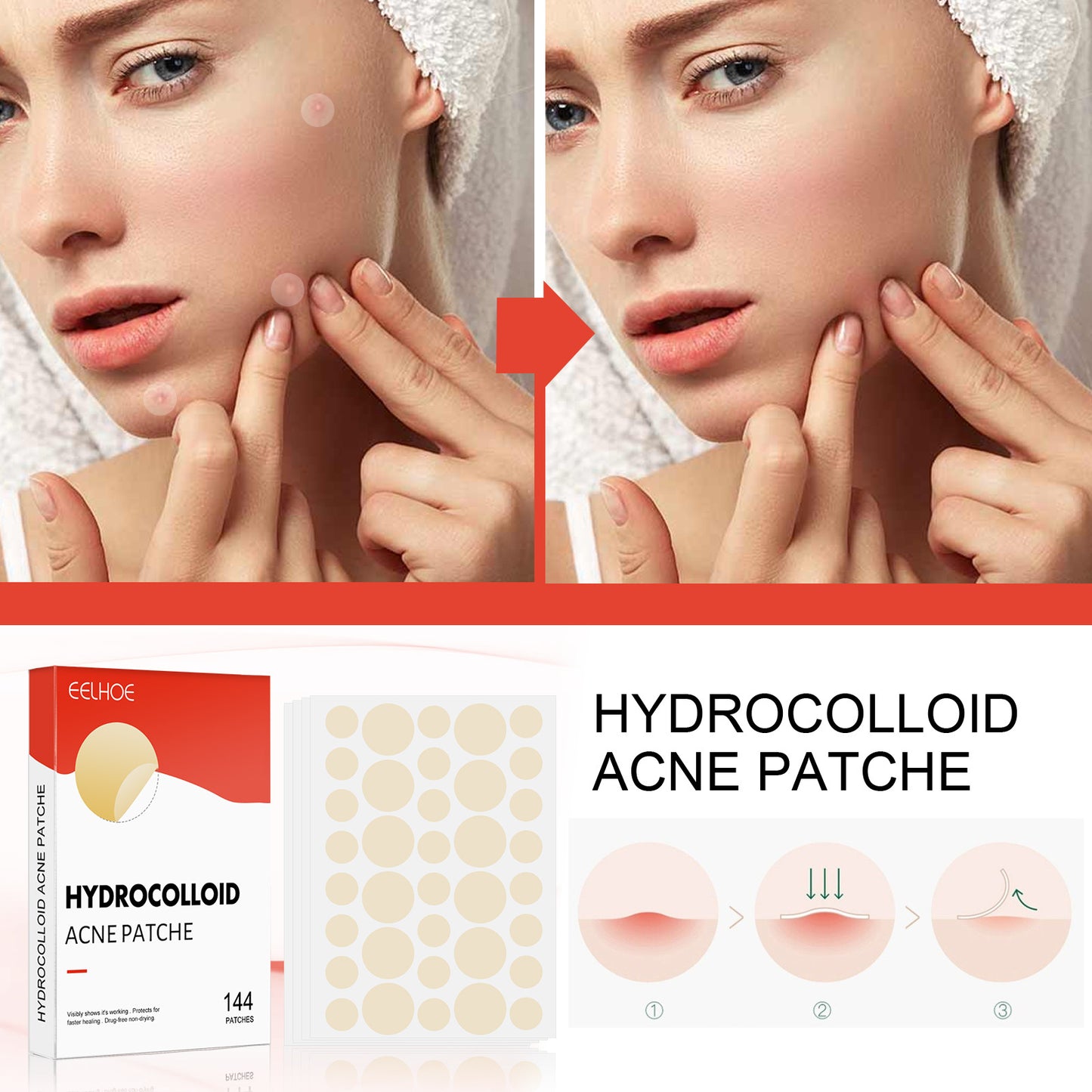 Clearovia Hydrocolloid Acne Patches